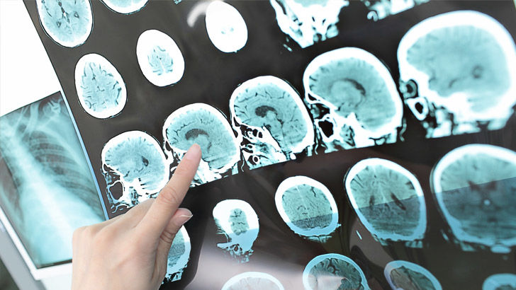 ct scan